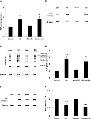 Non-canonical Interaction Between O-Linked N-Acetylglucosamine Transferase and miR-146a-5p Aggravates High Glucose-Induced Endothelial Inflammation